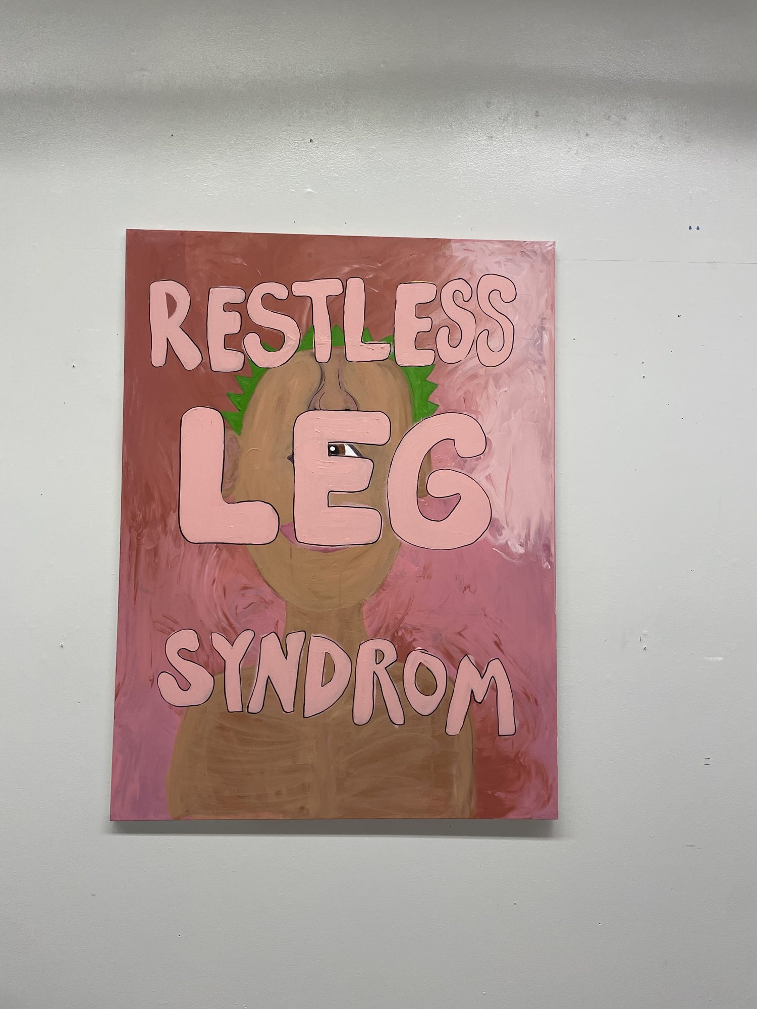 restless leg syndrome